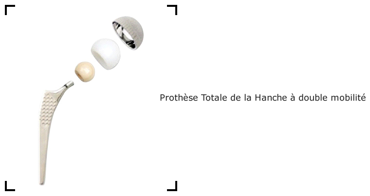 prothese-totale-de-la-hanche-a-double-mobilite
