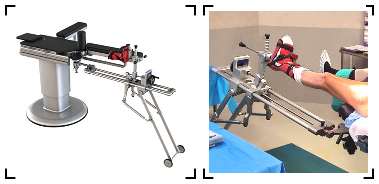 table-operatoire-chirurgie-prothese-de-la-hanche-par-voie-anterieure-mini-invasive